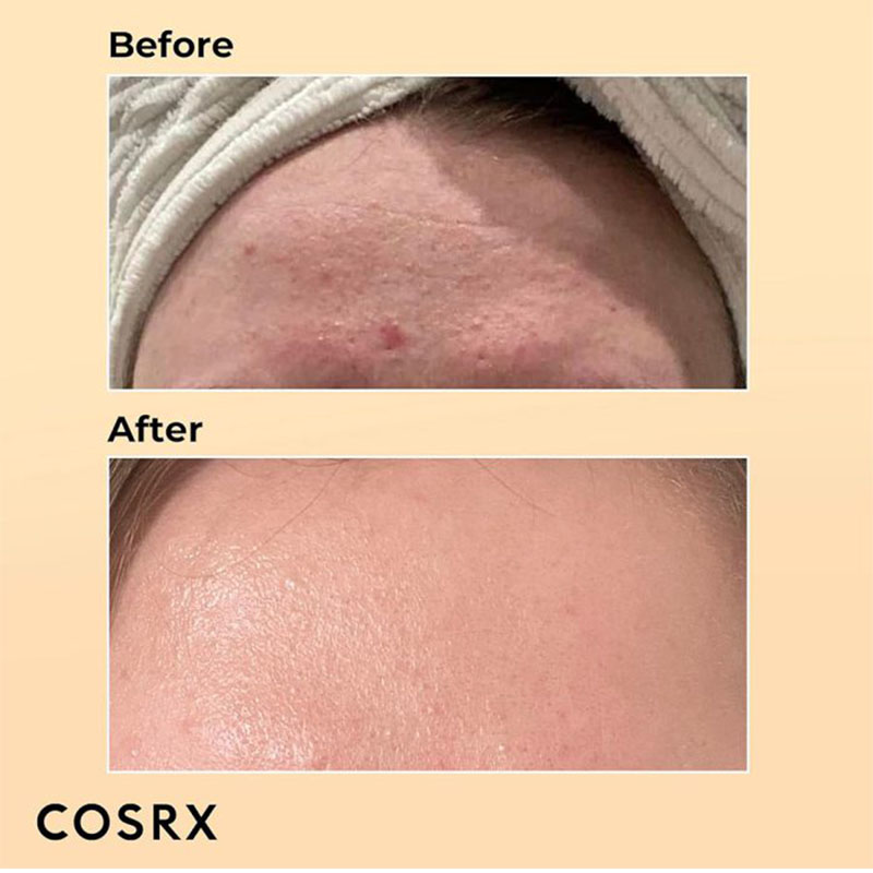 cosrx